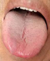 【舌诊分析】这个舌头看着没什么问题，其实心肝脾肾都得调！

我们来看这位患者的舌
