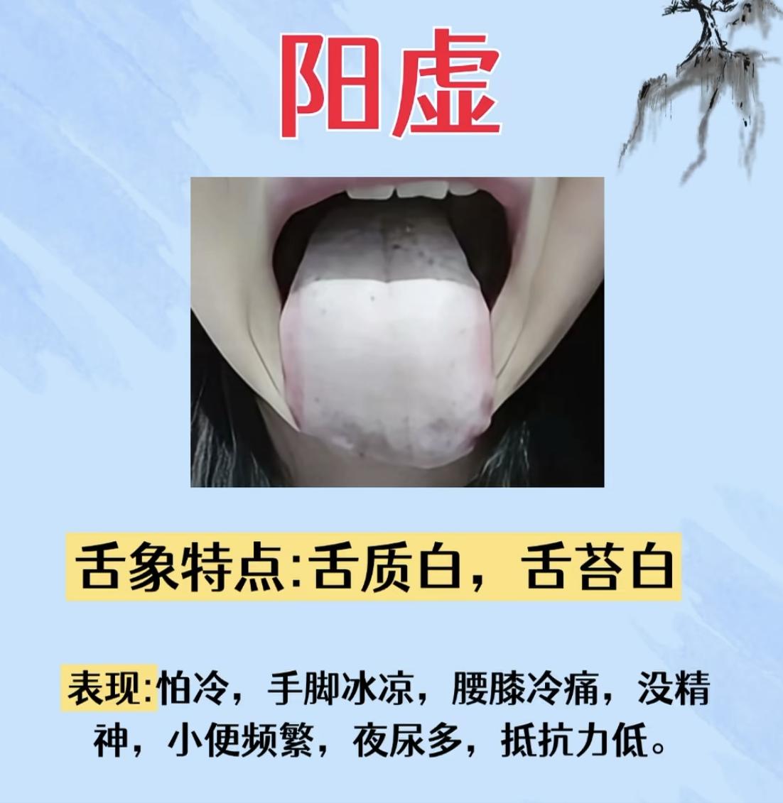 调理人体这四大虚，只要记住这四个方法，即可！

①阳虚——舌质淡白白，舌苔白腻