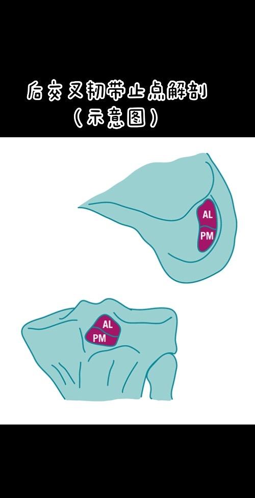 后交叉韧带止点解剖（示意图）