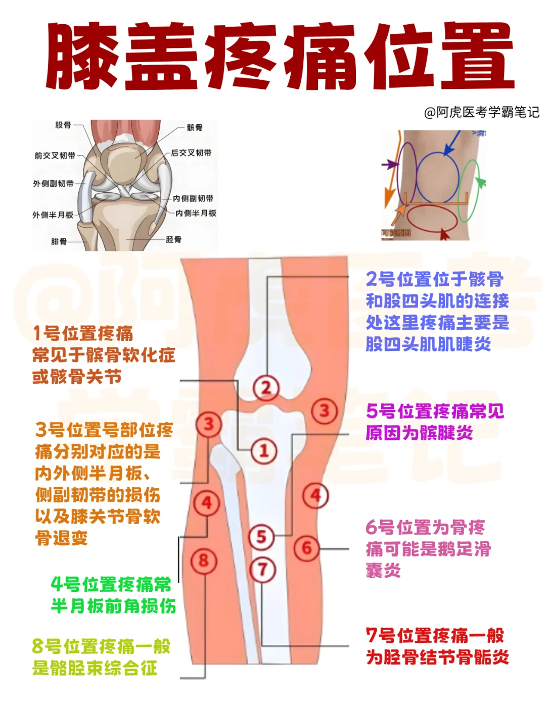 医学生笔记📒｜不同部位膝盖痛👆