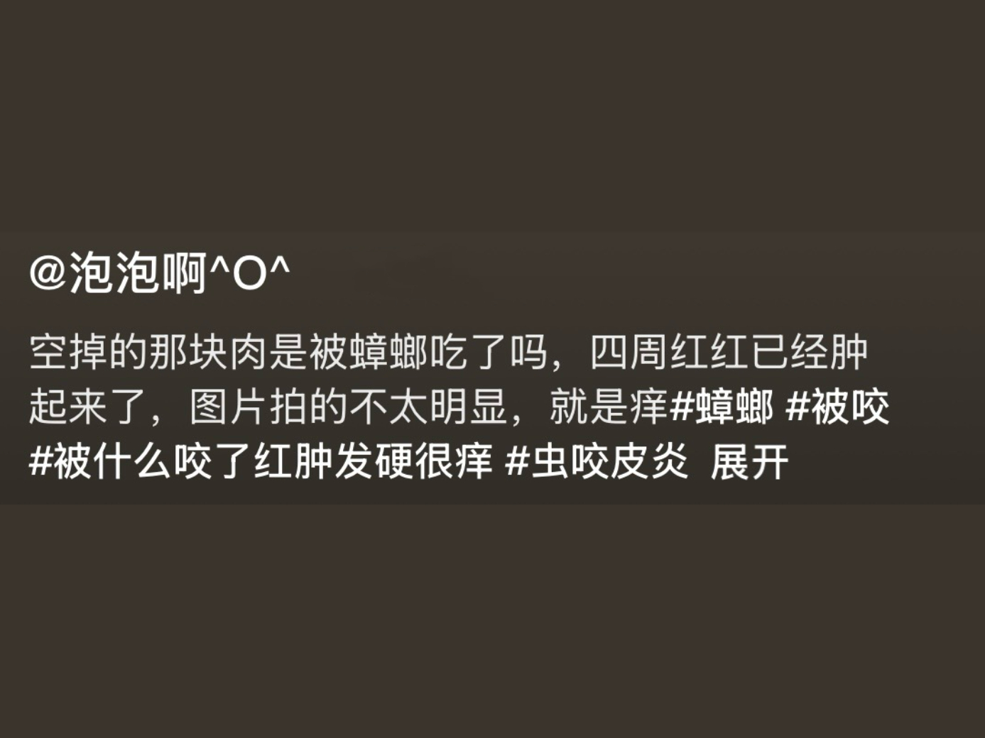 原来蟑螂真的会吃人啊 疑似世界上最可怕的事情出现了…… 