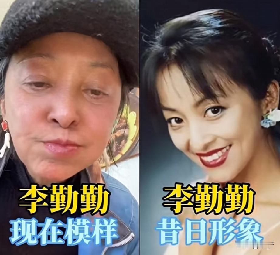 赵汝平、郭冬临、李勤勤、尤勇智、董勇，5位演员今昔对比！年轻时个个精神，谁是你心