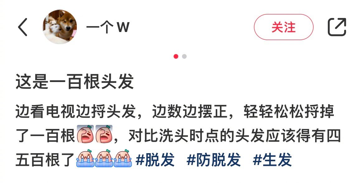 惊了！一百根头发就这么点？ ​​​