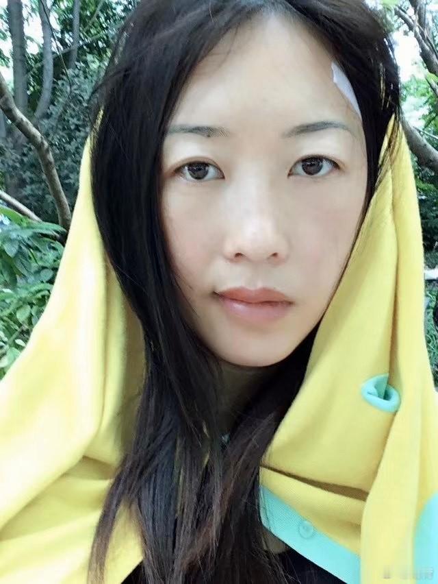 竟然翻到十年前做颞颌关节手术时候的照片，怪不得现在自拍觉得脸不对称，看照片可能就