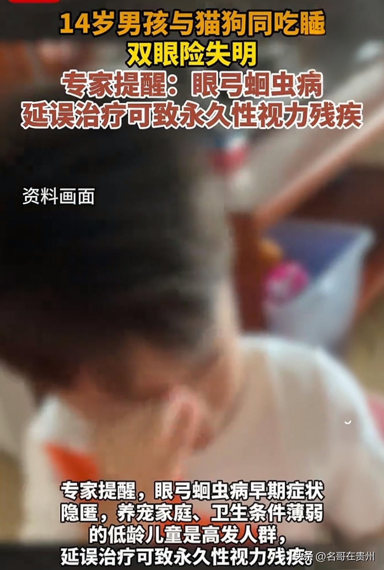 14岁男童近乎失明！医生痛心：这习惯很多家庭都有

跟猫狗同吃同睡一年多，湖北这