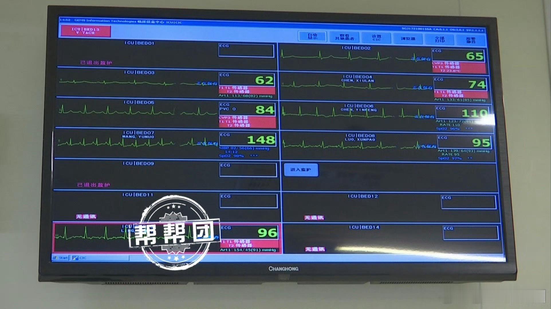 #福建男子接触鸵鸟后感染鹦鹉热导致缺氧# 【男子肺部功能几乎完全丧失，元凶竟是一