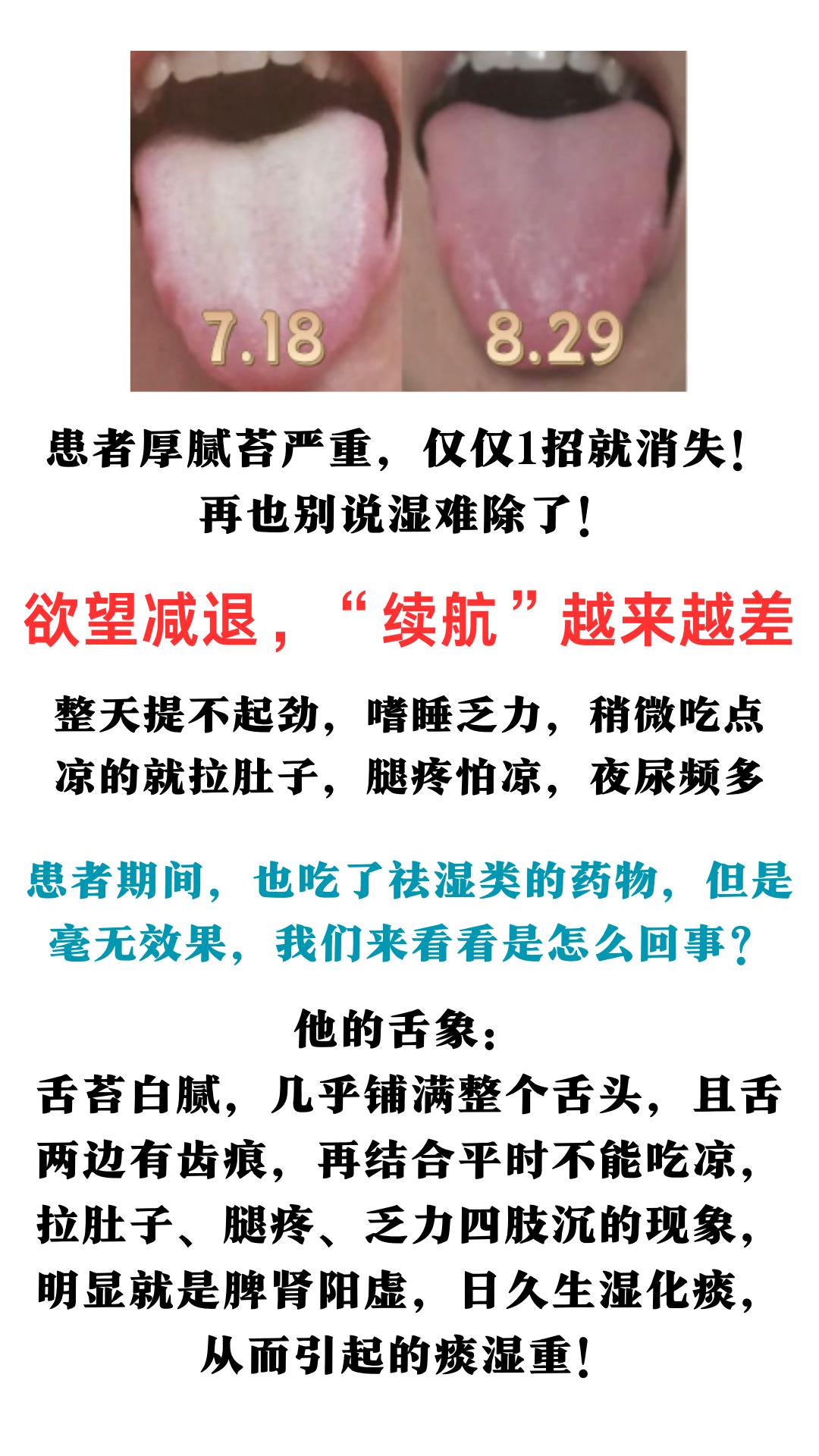 患者厚腻苔严重，仅仅1招就消失！再也别说湿难除了！#中医##健康科普##中药#