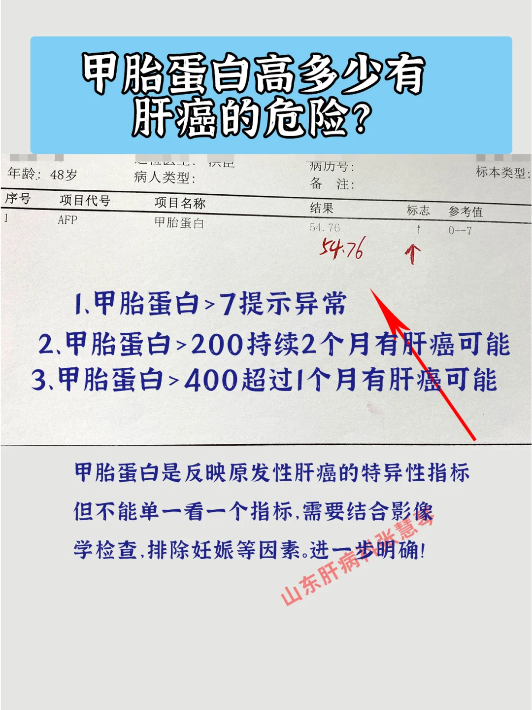 不容忽视！甲胎蛋白高多少有肝癌的危险？