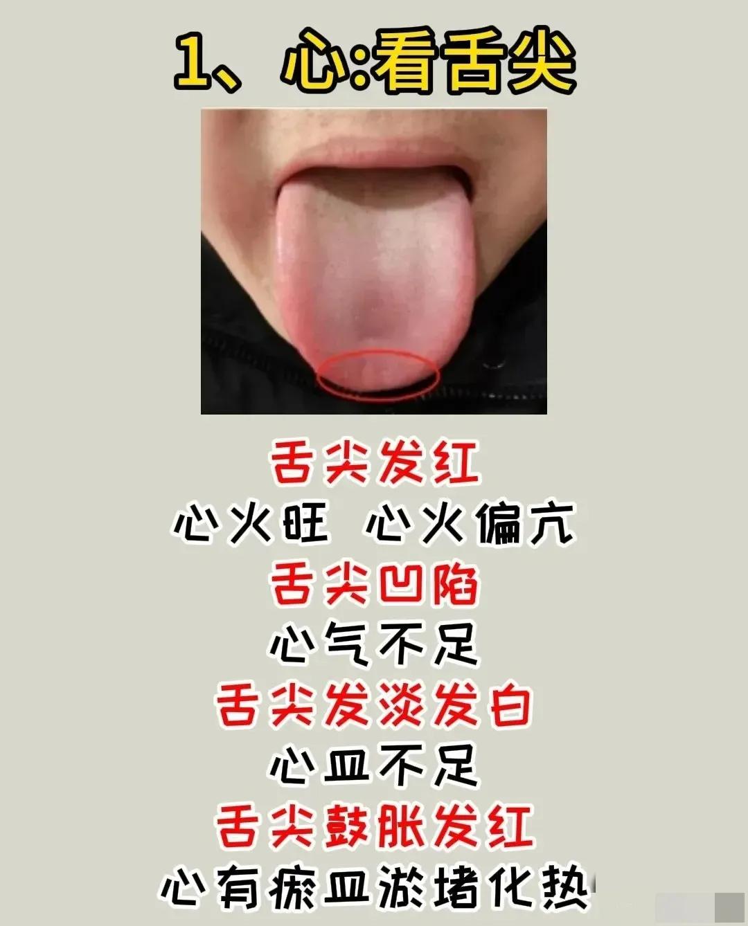 中医舌诊是一种通过观察舌头变化来诊断疾病的方法，你知道吗？通过观察舌头的不同部位