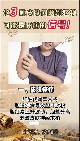 肝硬化 山东 医学科普 肝病