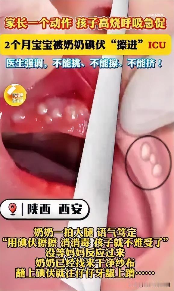 2025年12月，陕西西安一2个月大宝宝因牙龈出现黄白色“马牙”哭闹，奶奶误以为