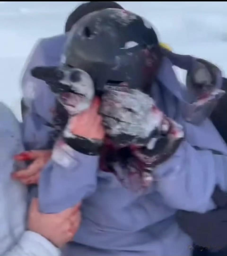 出事了‼️游客被新疆的雪豹咬伤，满脸是血。
近日新疆可可托海景区一只雪豹突然从雪