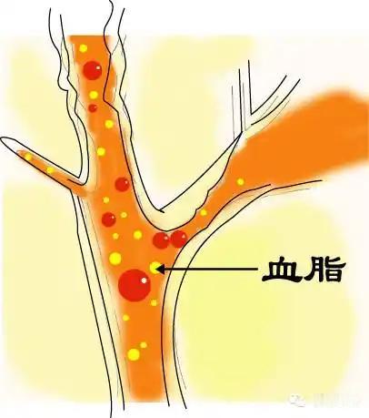 血脂太高怎么办？记住三个吃的原则，三个不吃原则

我国成人血脂异常患病率已突破4