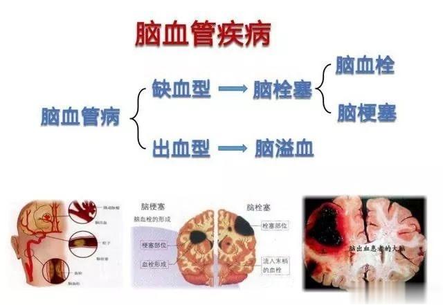 🔷心脑血管疾病的主要特点：1⃣️高发病率 ：发病率高达13.6％，每4个成年人
