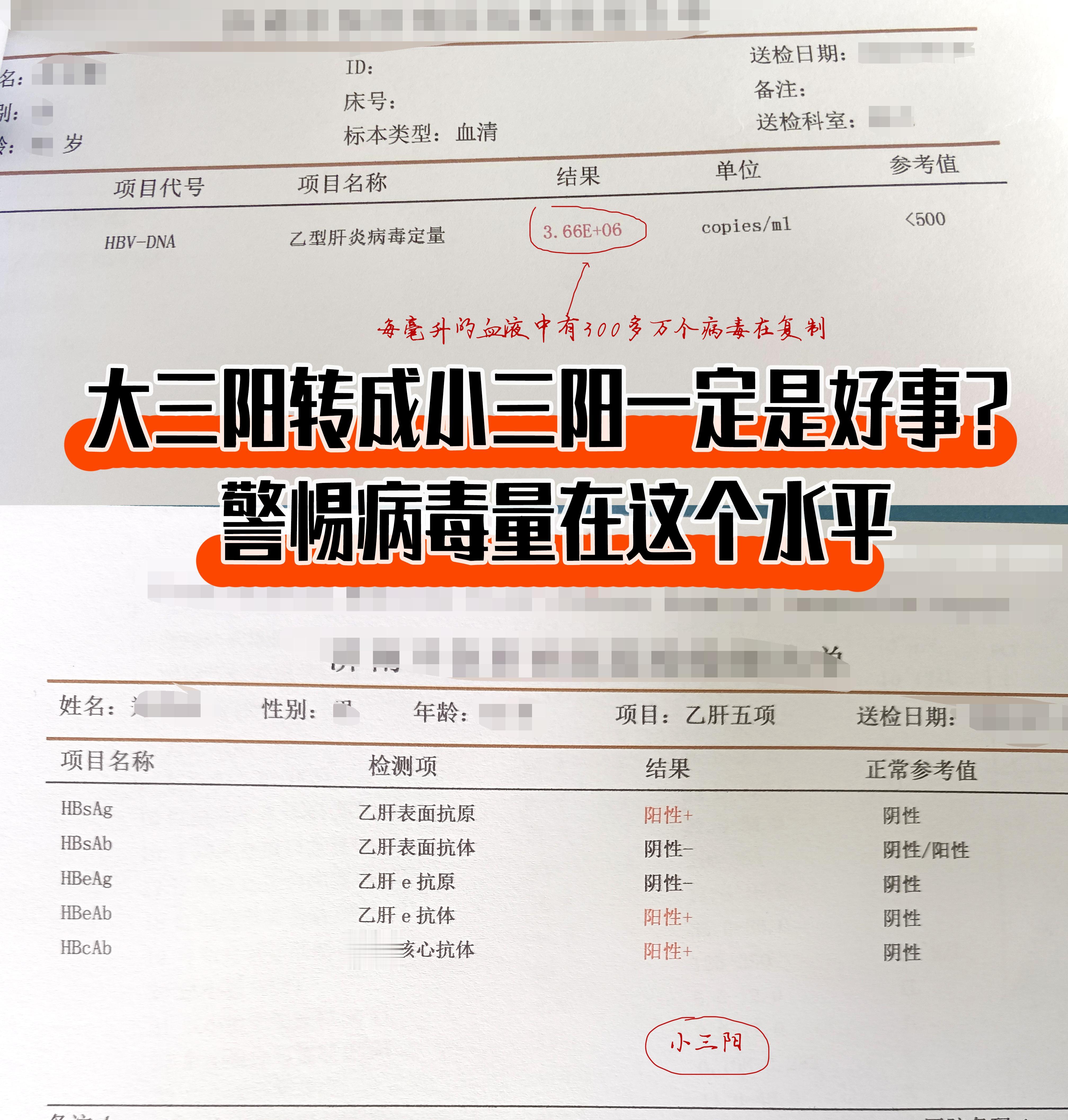 乙肝大三阳转成小三阳是好事?警惕病毒量在这个水平。  
德州粉丝朋友咨询：吴主任，我有乙肝5.6年了，大三阳，从去年11月份开始治疗，病毒量在8次方，现在吃恩替卡韦治疗半年多时间了，端午假期去复查转成小三阳了，病毒量在3.66E+06，请问有什么方法降低病毒量吗?  
【回复】就大部分患者的情况而言，大三阳之所以会转为小三阳，可能是因为患者自身的免疫力增强，削弱了部分乙肝病毒的活性，导致乙肝病毒在人体内的复制减弱，其活力与传染性也比大三阳的要弱一些。绝大多数小三阳患者病毒量会在10的3次方上下徘徊。