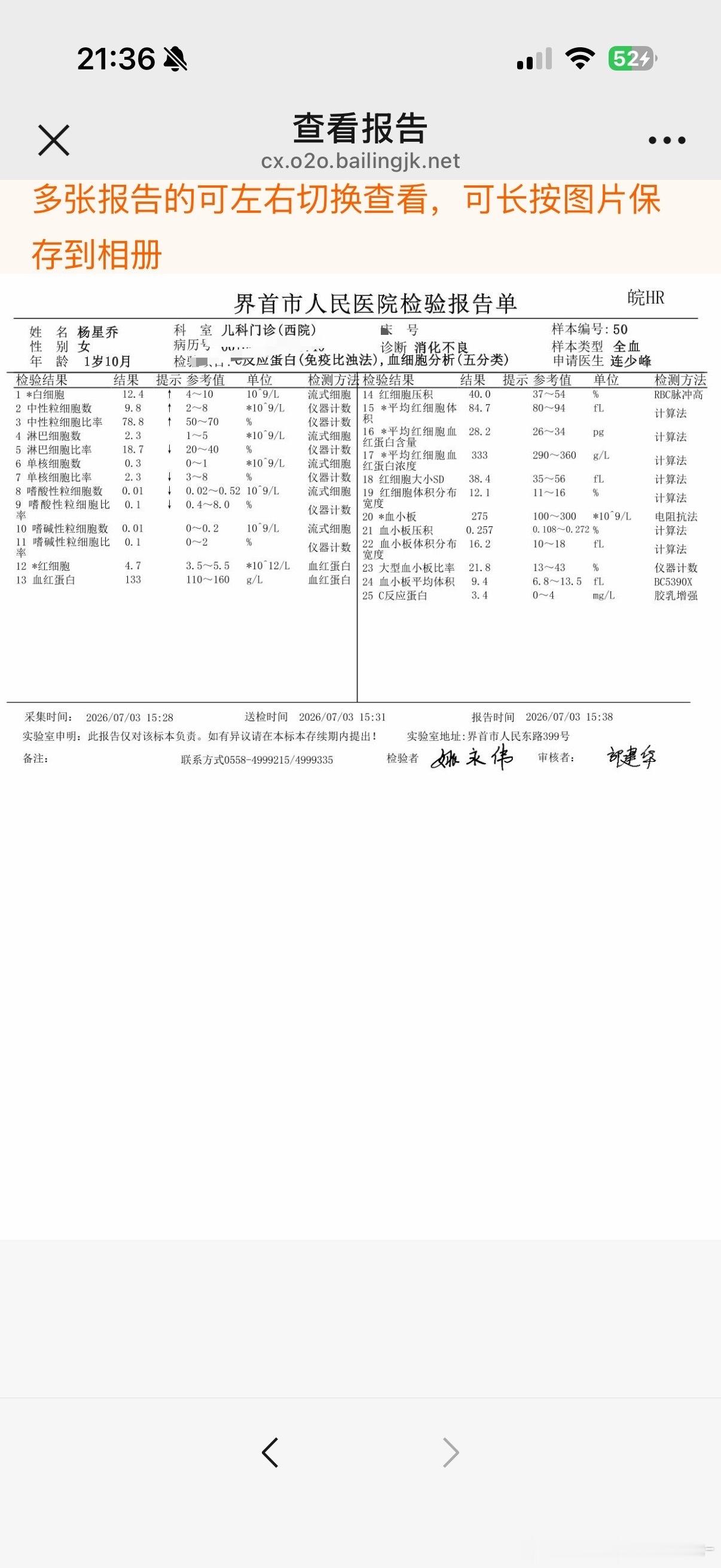 前天晚上八点拉肚子一次，九点一次。昨天拉两次，吐一次，精神状态不好。今天睡醒看我
