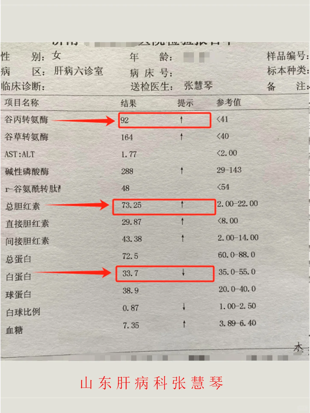 危险！复查肝功能，4个指标别超过这个数↓