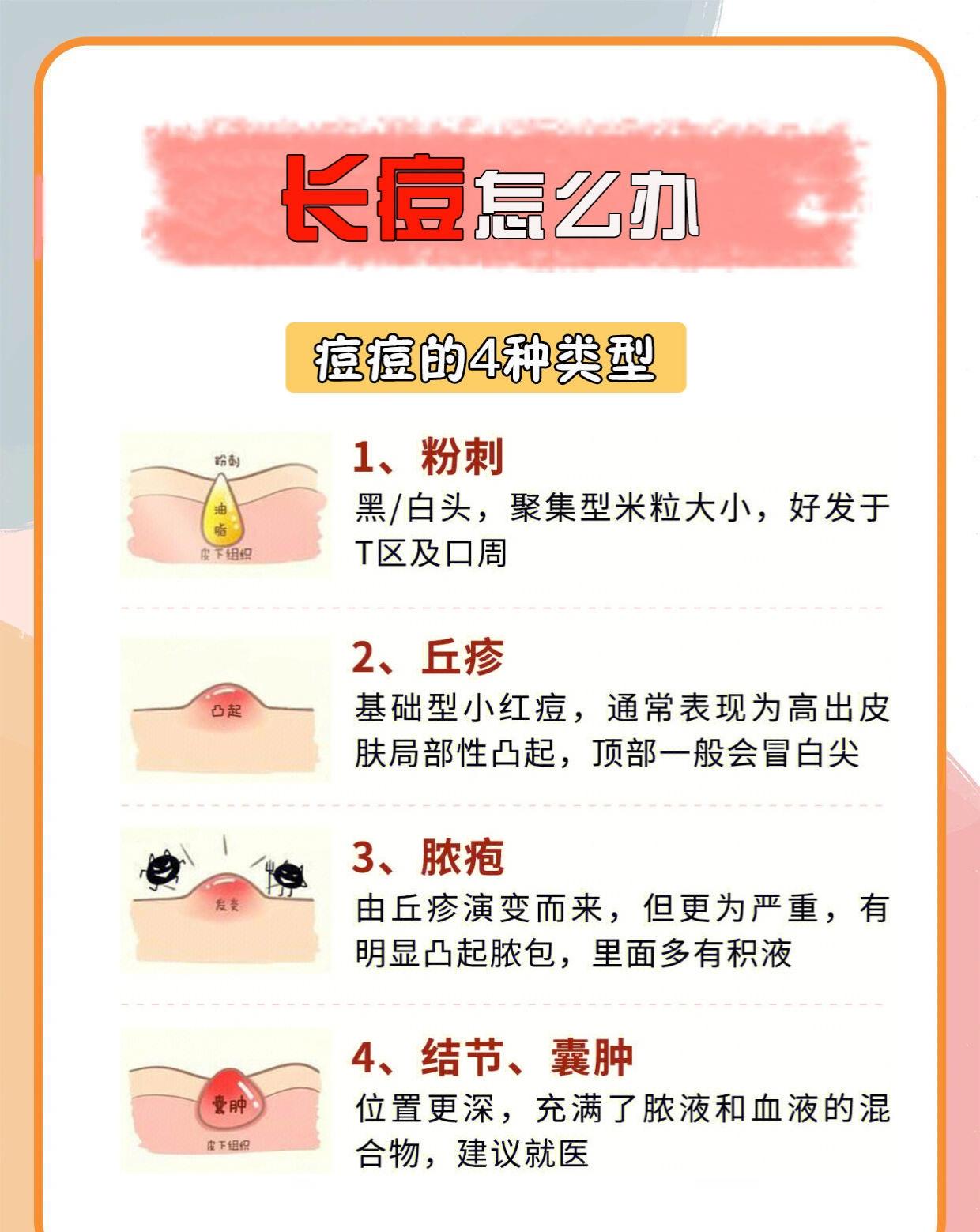 长痘怎么办。祛痘如何拯救痘痘肌