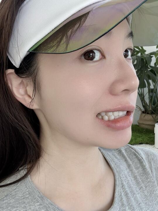 才3个月牙贴片碎了