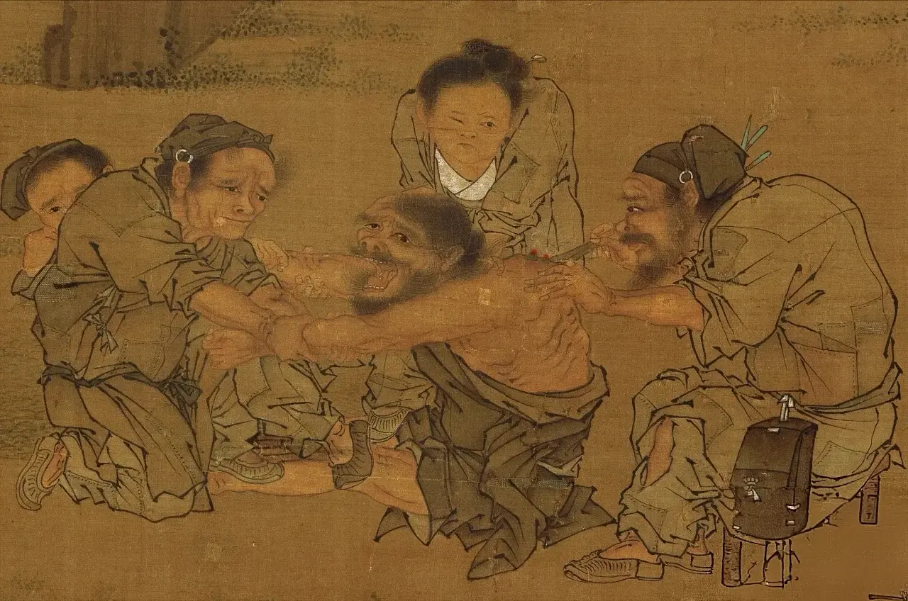 宋代就有艾灸。《村医图》或《灸艾图》。这是李唐古老前辈画的,绢本淡设色...