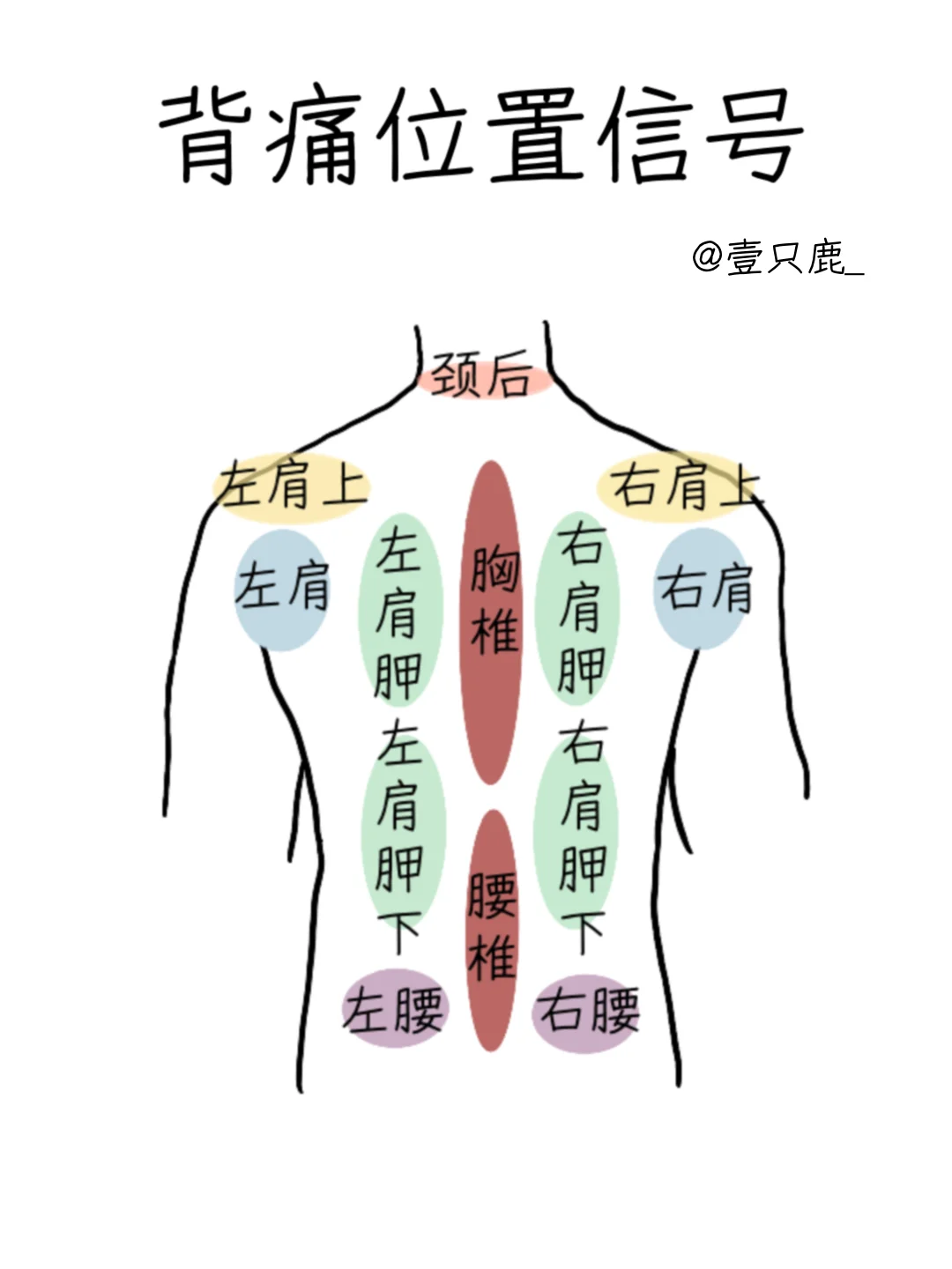 医学生笔记📝｜背痛位置信号
