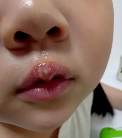 孩子身上的伤，真的只是“不小心磕碰”吗？

看完徐州丰县那幼儿园的监控，真的上头
