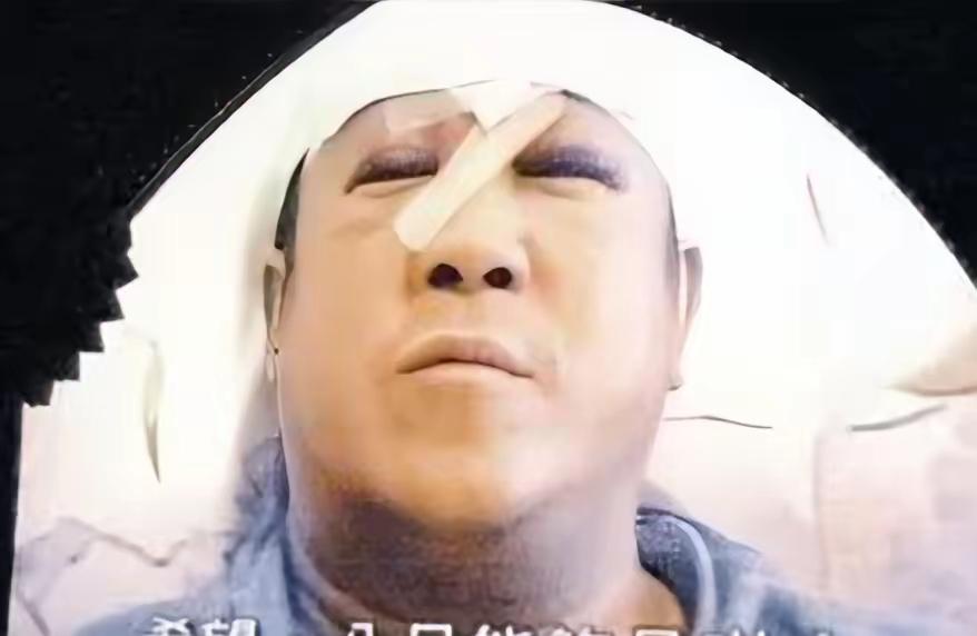 2001年，曾志伟刚从酒吧出来，就被几名壮汉狠揍了一顿。送医后，他被缝了29针，