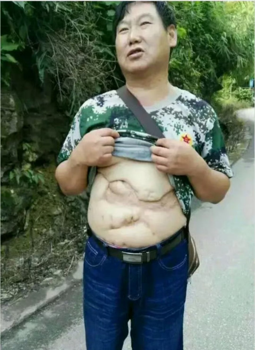 他把衣服掀起来的那一刻，肚皮中的"地图"让人感到震撼！他就是老山某炮团二营副营长