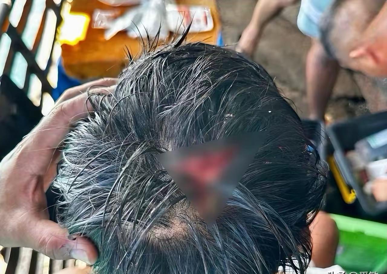 当场开瓢，菲律宾被揍了。7月20日，菲律宾军方发布声明，一名菲律宾海军人员在南海