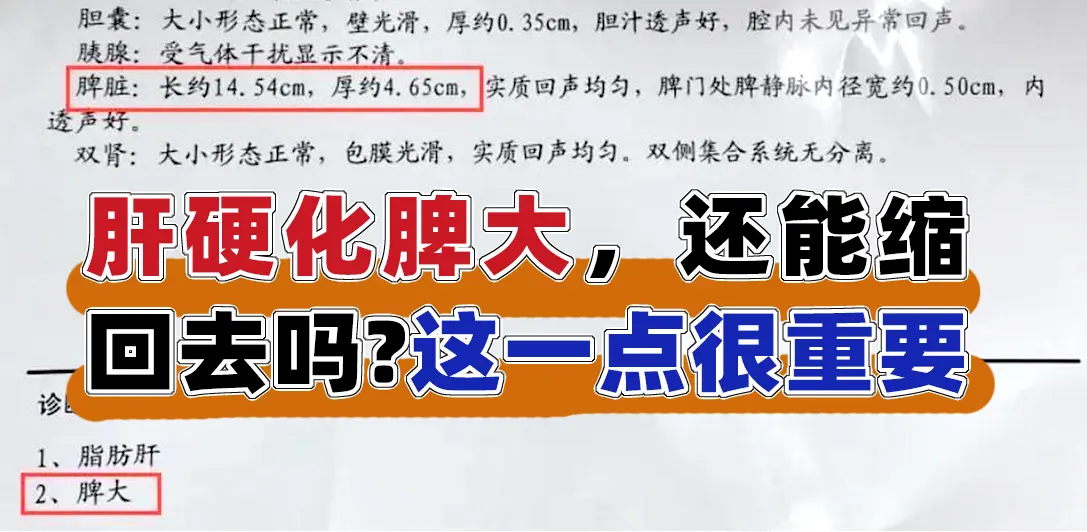 肝硬化脾大，还能缩回去吗?这一点很重要  前两天接诊了一位山东长清的患...