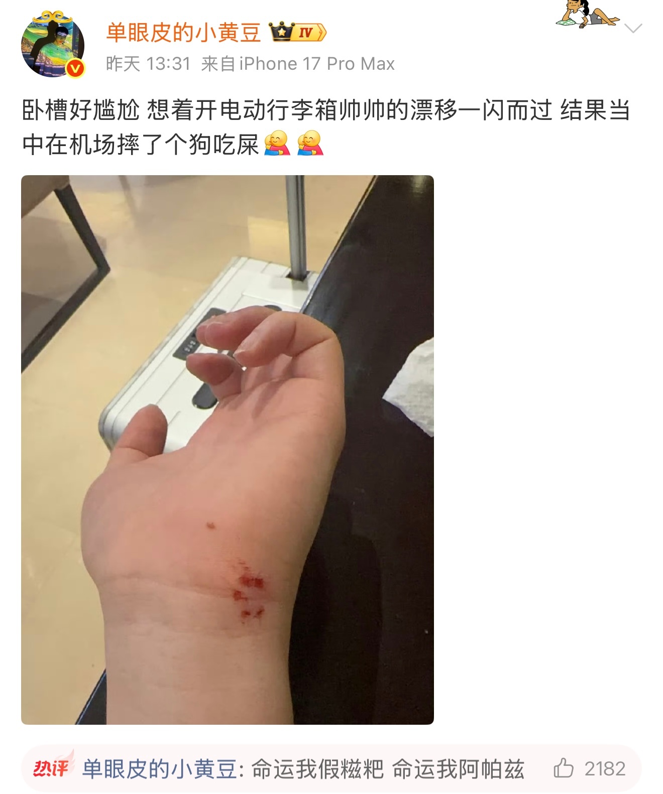 小黄豆摔了小黄豆在机场摔了小黄豆想开电动行李箱耍帅漂移，不料在机场当众摔倒，手掌