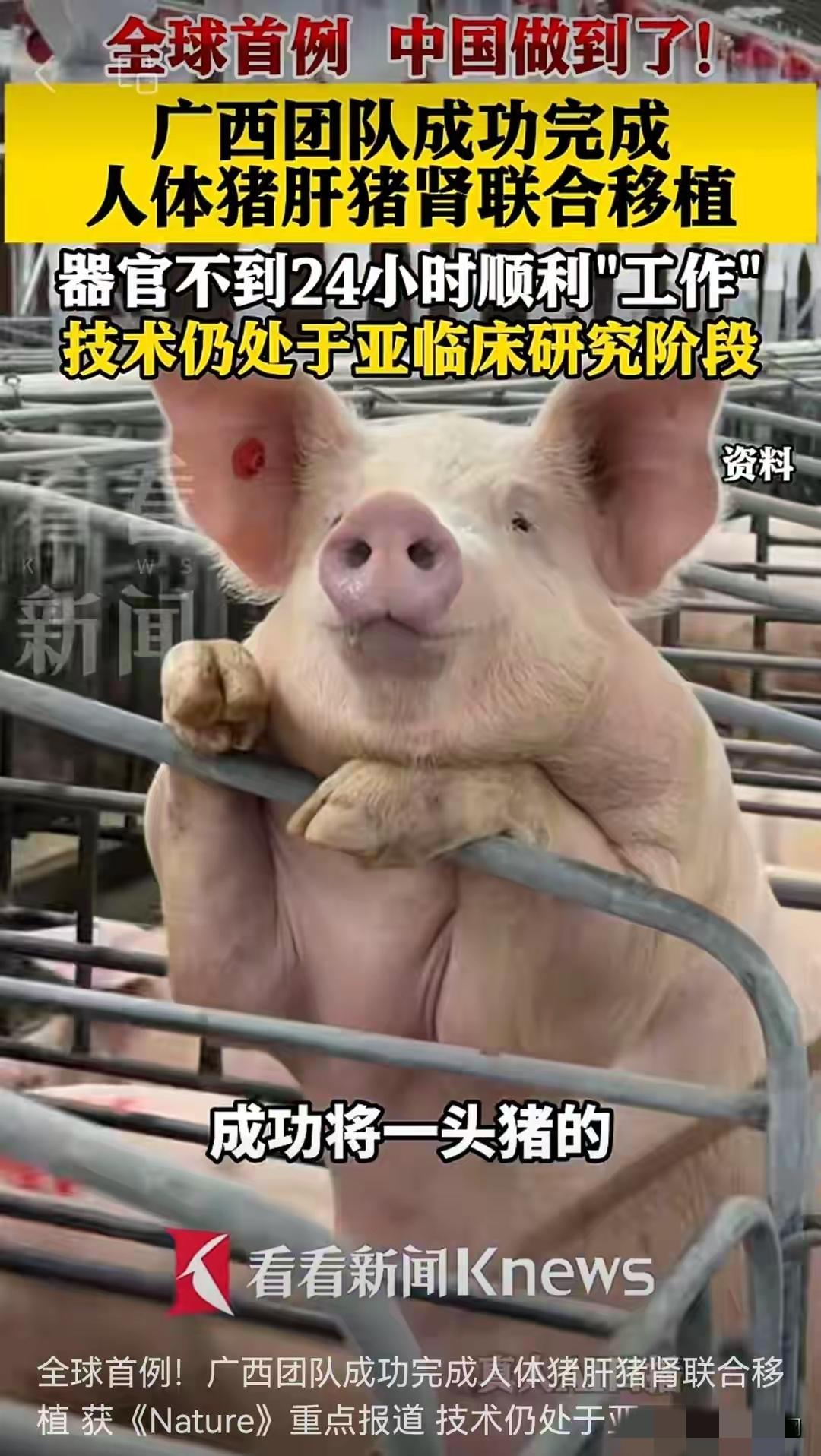 全球首例！广西团队成功将猪肝猪肾同时移植进一名53岁脑死亡男性体内，不到24小时