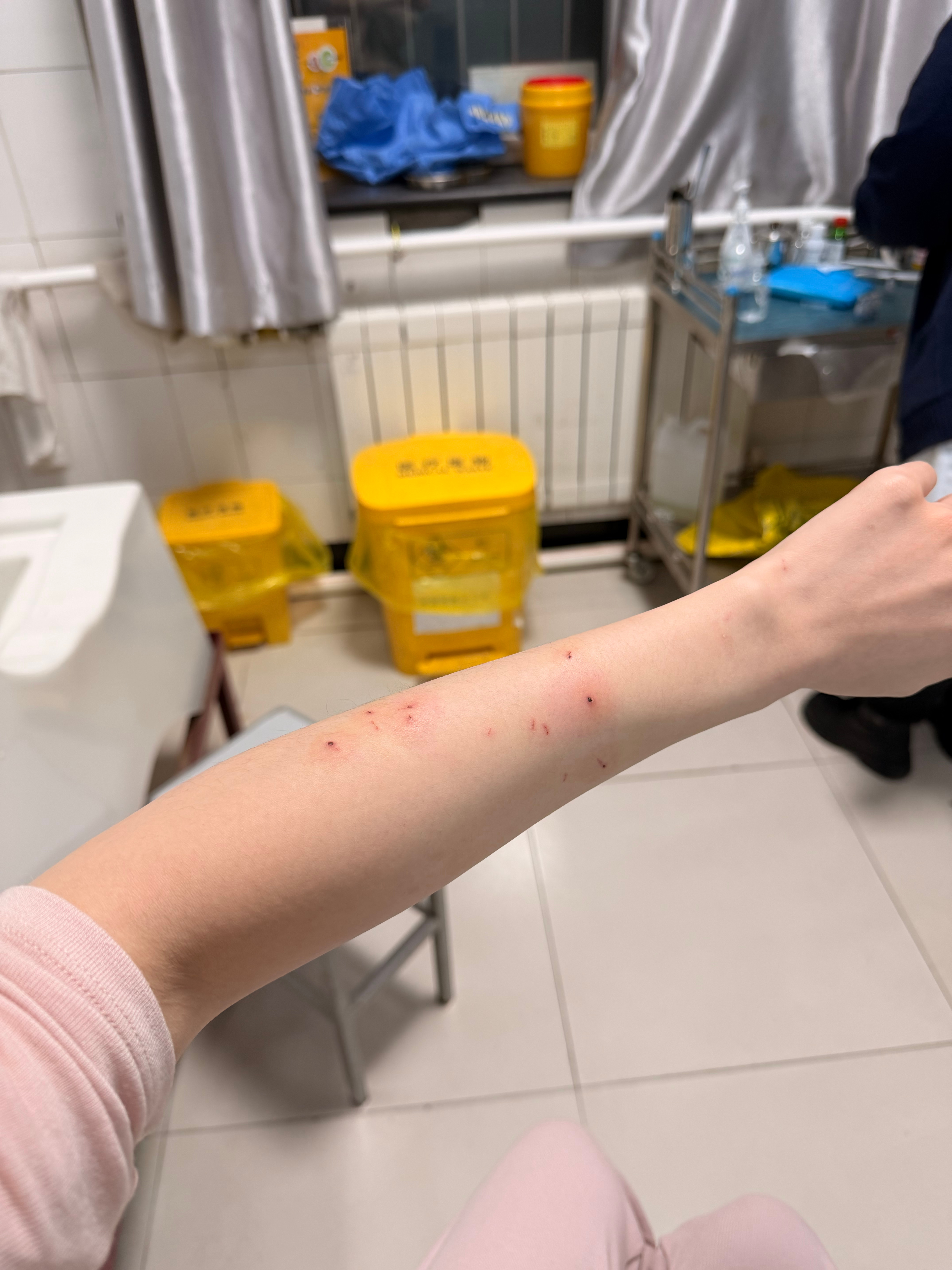 第一次打针泪流满面，痛 实在太痛了 