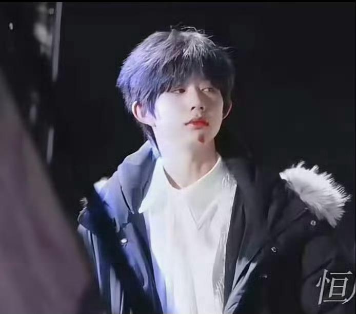 陈奕恒下巴受伤了？陈奕恒受伤