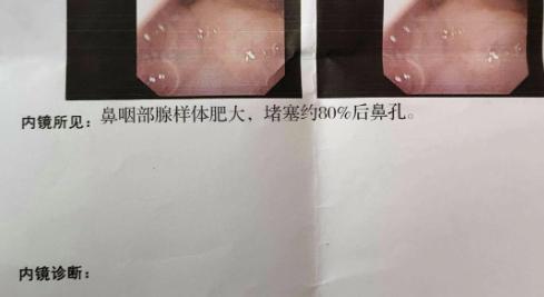 坦白讲：孩子腺样体肥大从4/5缩小到0.28，“只用了一碗汤”，错过是你的损失！