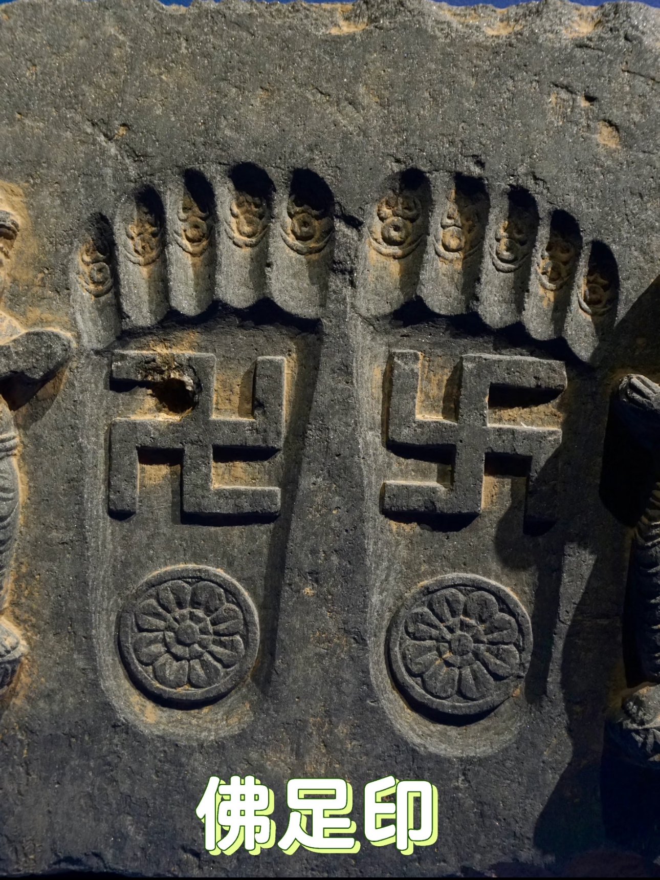 福德和智慧就像人的两只脚，在世间生活和成就都必须要靠这两只脚。没福德就没健康的身