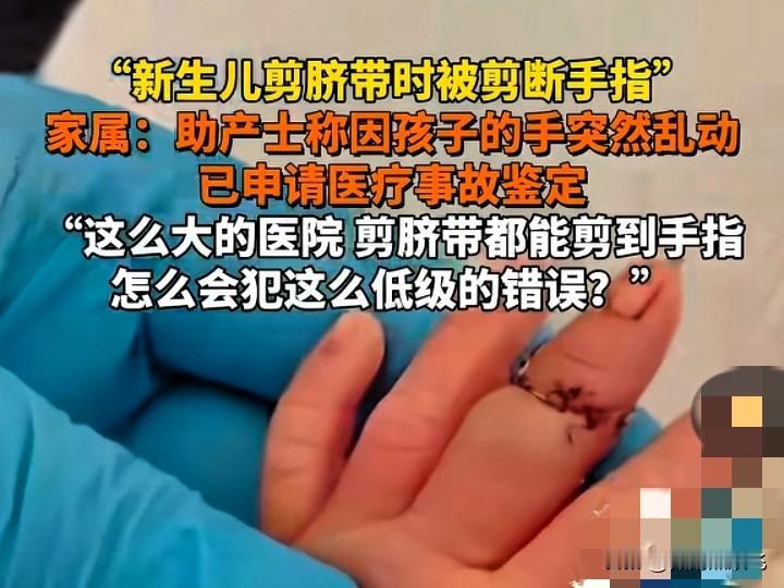 比特朗普还离谱，离谱没边了！助产士给出生的宝宝剪脐带，竟然能够把宝宝的手指头剪断