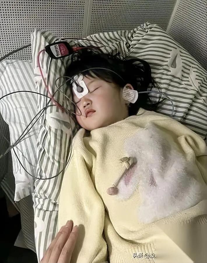安徽女孩被打至骨折？

医院照片让人揪心…

妈妈晒出的画面里，孩子头上贴着电极