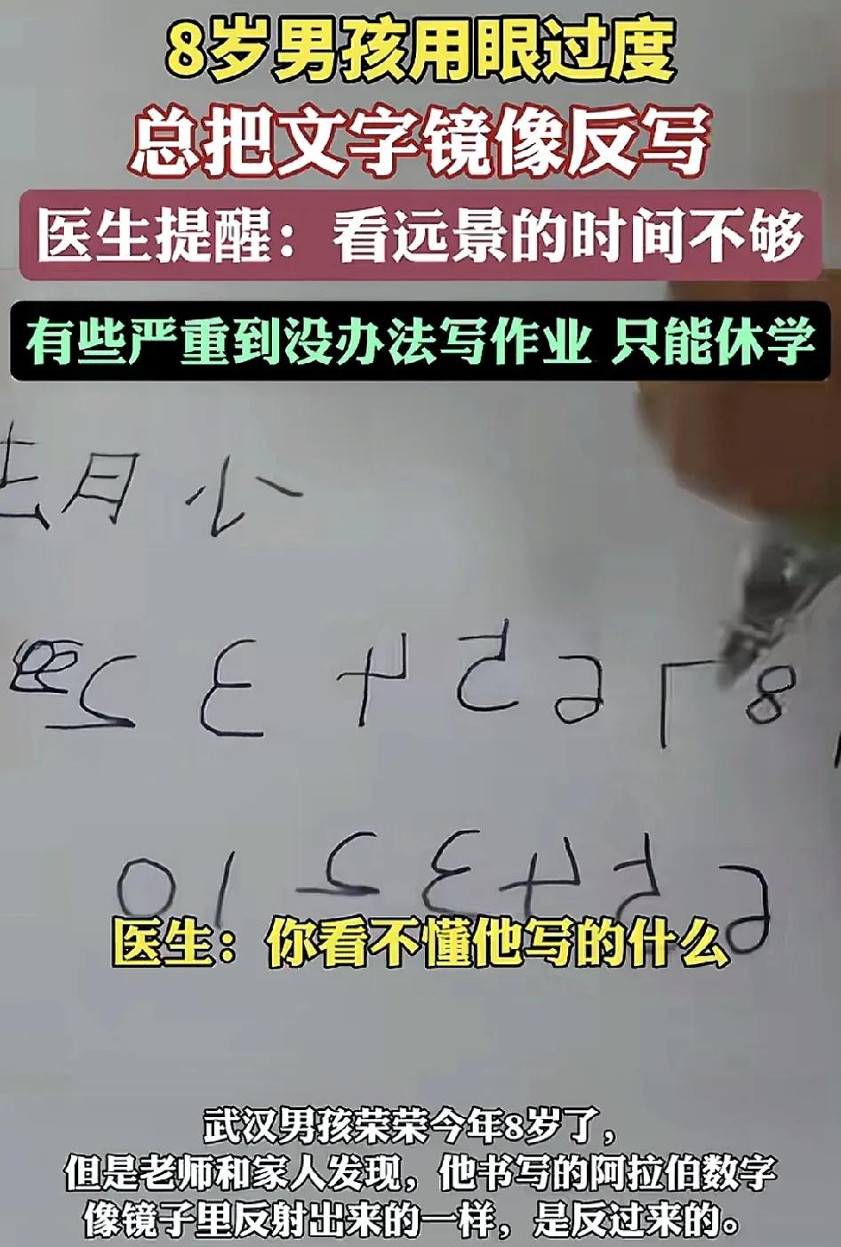 近日，武汉一位8岁的男孩被家长带到医院看眼科，该名男孩平时写阿拉伯数字的时候总是