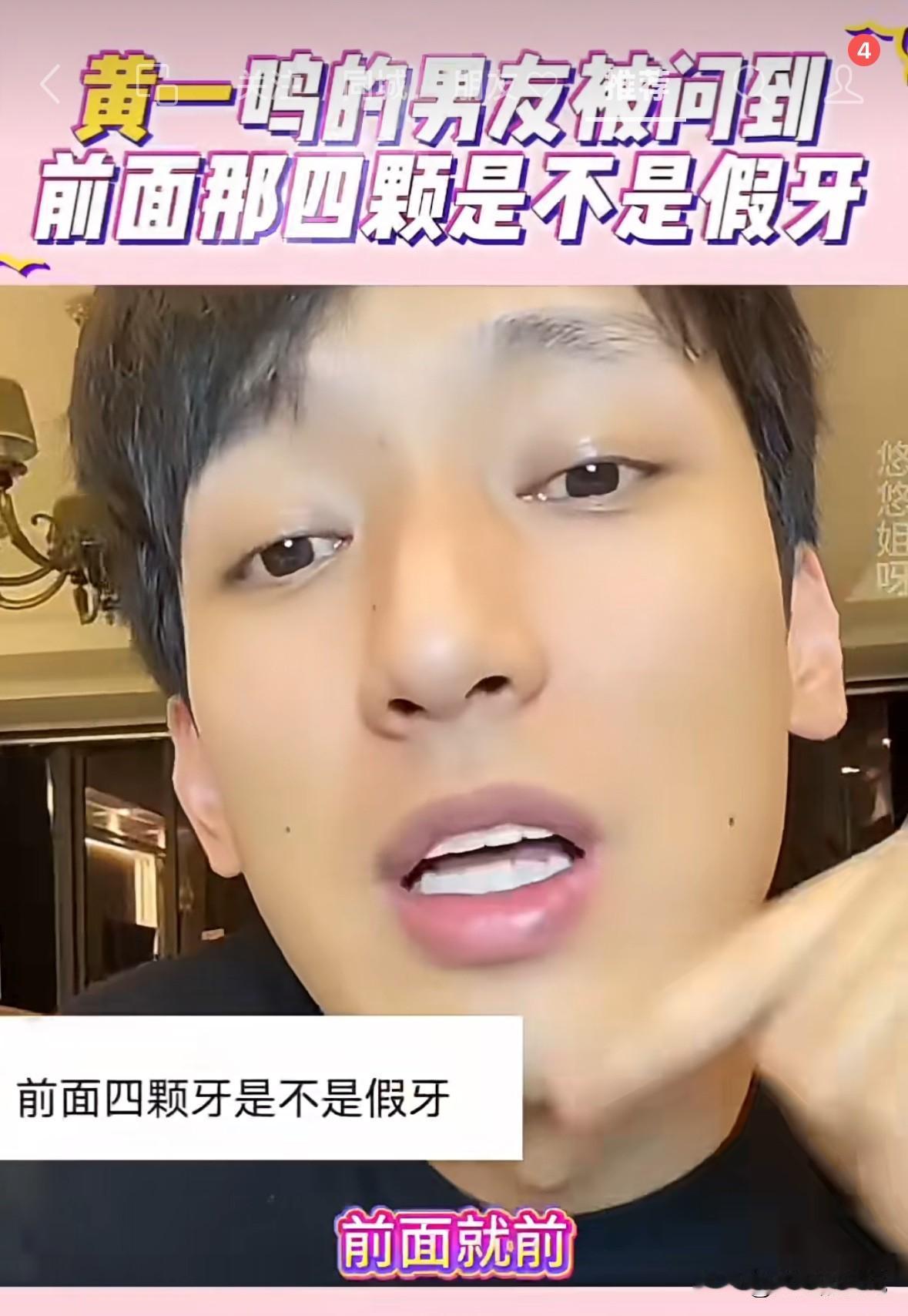 黄一鸣新男友直播了，他承认前面的牙齿都是假的，难怪大家都说看他前面的牙不舒服呢。