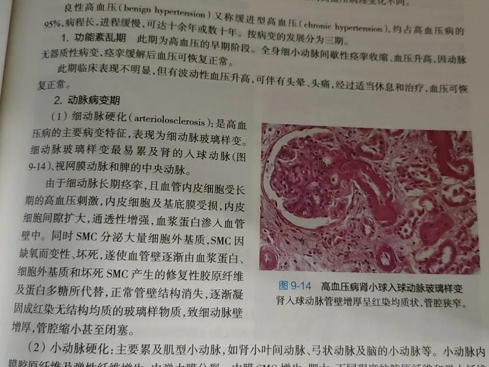 血压正常了，就不用吃降压药了？医学生告诉你，大错特错！

可能在大多数得高血压的