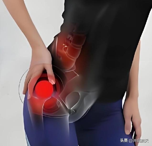 乒乓球打久了，现在右侧胯骨轴子疼。还能不能打了？
现在走路不碍事，但是想坐下的时