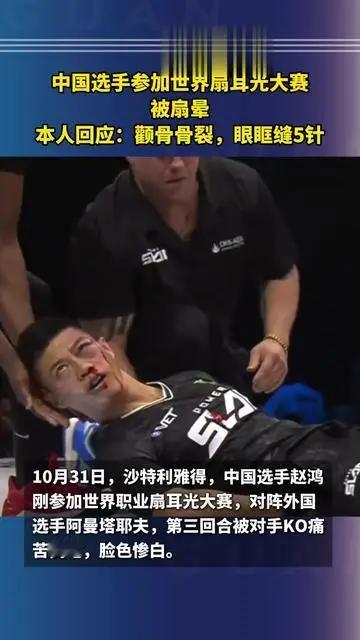 无冤无仇怒目圆，
啪啪打脸互相残。
鼻青脸肿血四溅，
何甘挨打手不还？

你来我