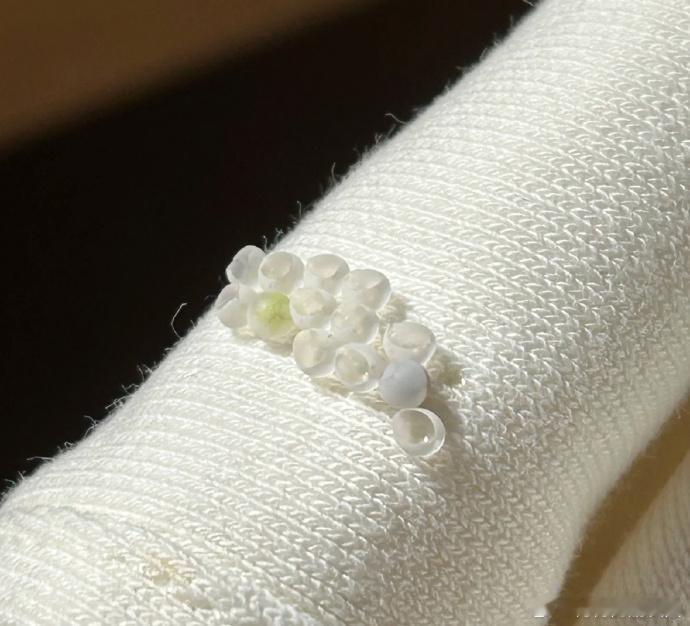 衣服上这莫名的小凸起，是啥呀？难道真像刷到的那样，甲壳虫来产卵了？不会这么倒霉吧