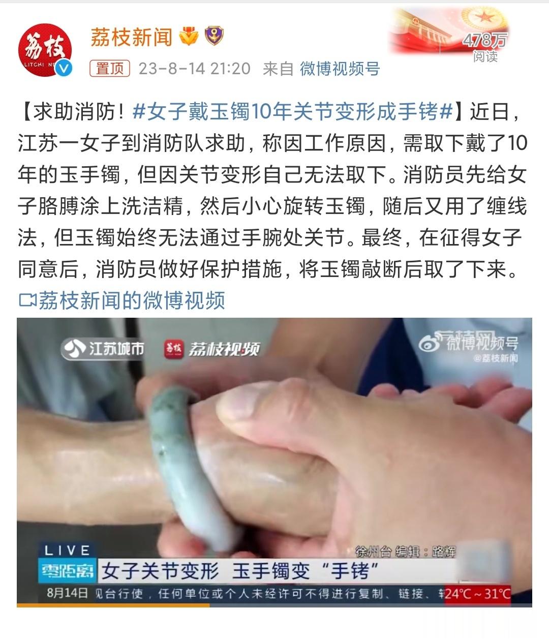 #女子戴玉镯10年关节变形成手铐# 注意，不是戴手镯导致关节变形，是关节变形导致