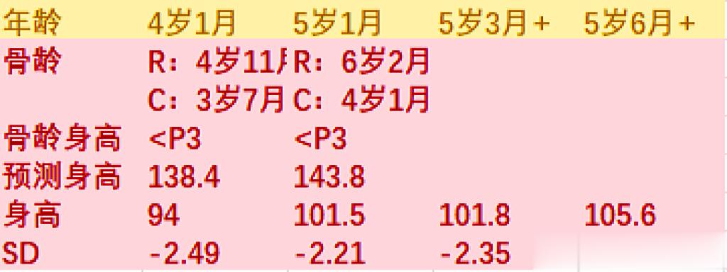 遗传性身矮的娃，使用生长激素3个月后，身高长了将近4厘米，从➖2.35个标准差，