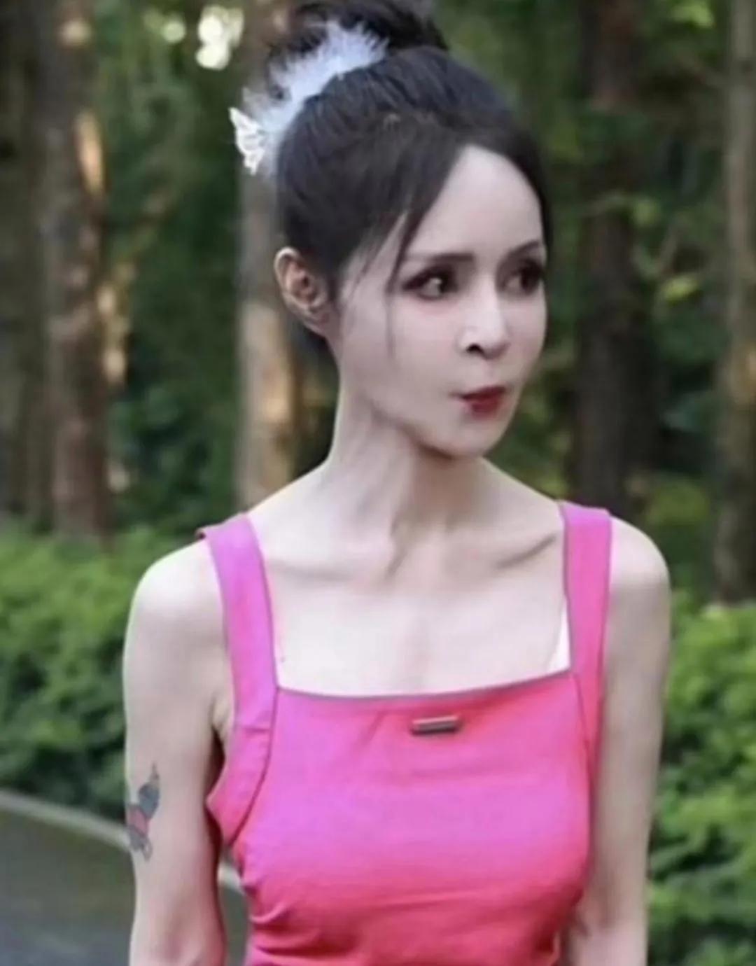 天呐！这还是那个人美歌甜的高胜美吗？脸看起来有点吓人，骨瘦如柴，看着已经不食人间