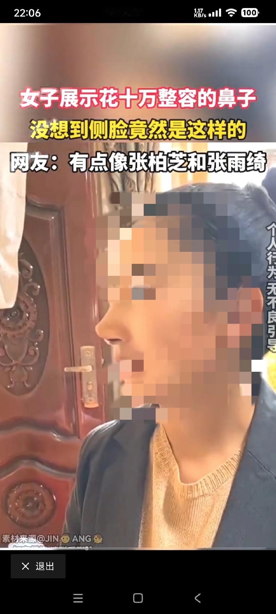 这位女生的侧脸看起来像张柏芝，又像张雨绮。
她不是天生就长这样子。

她向网友展