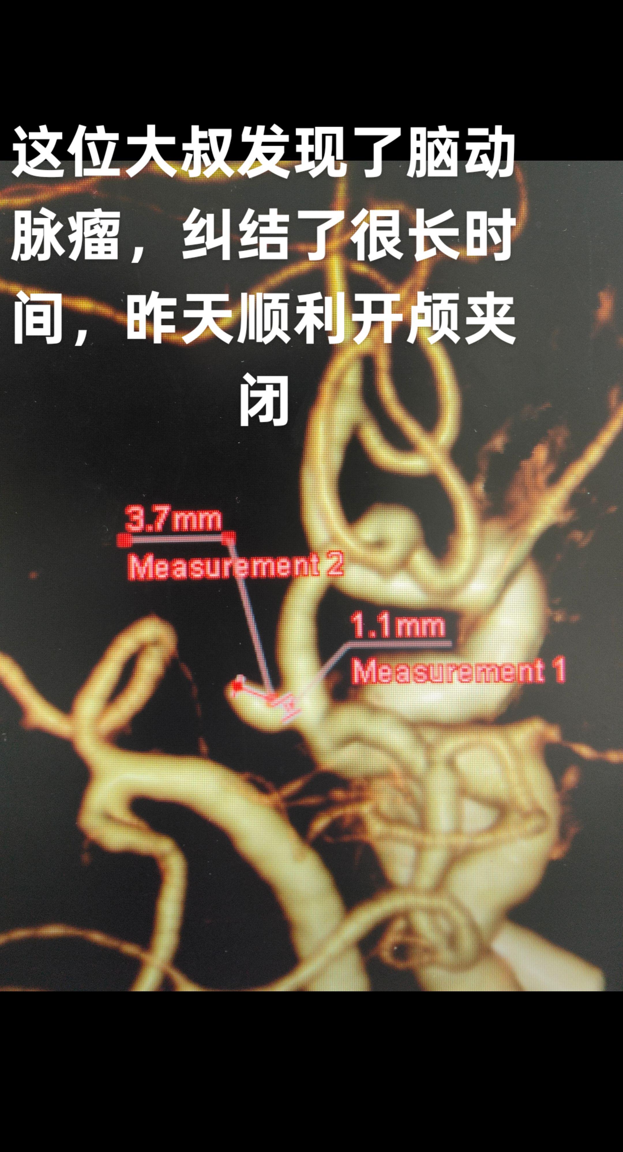 每日分享