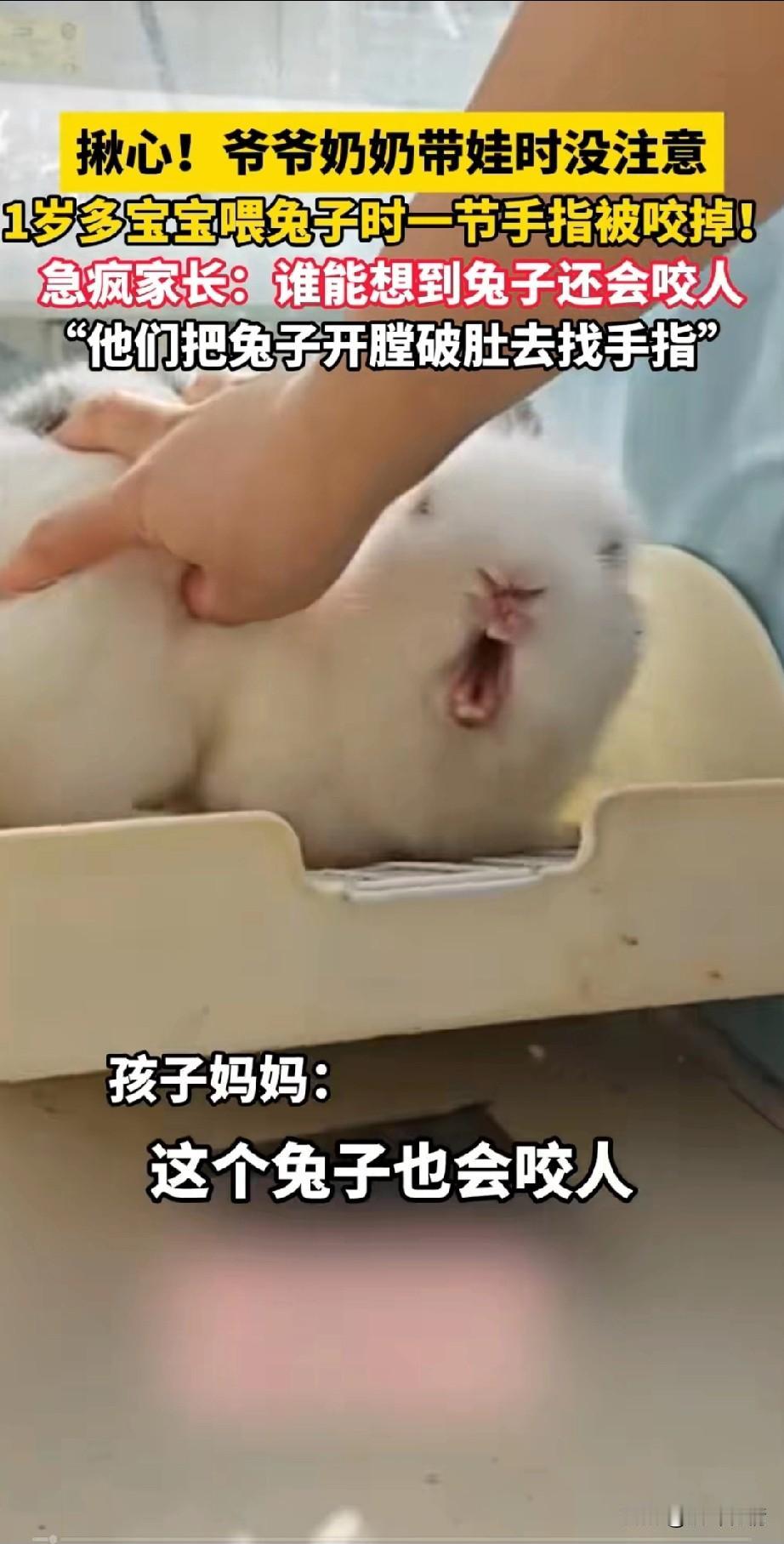 实在太揪心了，1岁萌娃喂兔子时手指被咬断，这可吓坏了他才见着你，紧急将他送到了郑